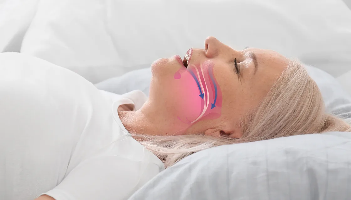 Halifax entrepreneur wants to revolutionize sleep apnea treatment